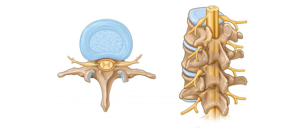 Нейросифилис: поражение спинного мозга